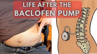 From uncontrollable spasms to relaxed limbs  Life before and after a Baclofen Pump [upl. by Abijah526]