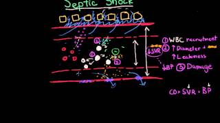 Septic Shock Pathophysiology and Symptoms [upl. by Amick]