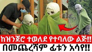 ከዝንጀሮ ተወለደ የተባለው ልጅበመጨረሻም ፊቱን አሳየ [upl. by Yanahs]