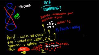 Treatment of Sickle Cell Anemia [upl. by Aker]