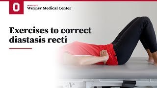 Exercises to correct diastasis recti  Ohio State Medical Center [upl. by Ycinuq]