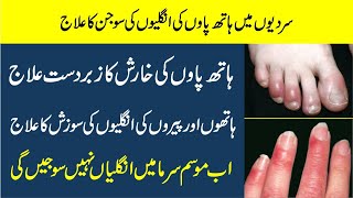 Hathon or paon ki ungliyon Ki Sojan Ka ilaj  Fingers swelling in winter  chilblain treatment urdu [upl. by Mccurdy979]