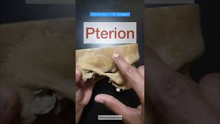 PTERION  EPIDURAL HEMATOMA anatomy headampneck mbbs mbbslife viral youtubeshorts shorts aiims [upl. by Sillyhp]