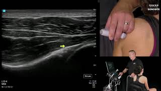 Webinar Diagnostic Shoulder Exams  Posterior Shoulder [upl. by Nnayhs]