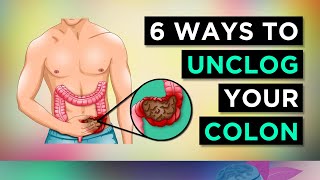 6 Ways To CLEAR Your CONSTIPATION [upl. by Akissej]