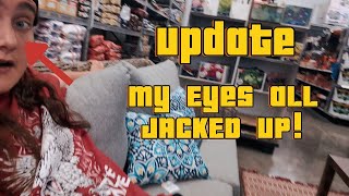 Update My Eye Has Cat Scratch Fever [upl. by Caddric]