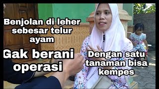 Cara mengobati benjolan di Leher tanpa operasi hanya dengan satu tanaman saja [upl. by Eirdua]