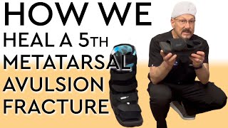 How We Heal a 5th Metatarsal Avulsion Fracture [upl. by Sherfield242]