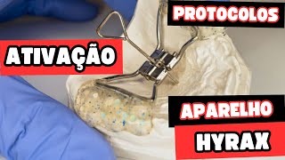 Como deve ser feita a ativação do aparelho Hyrax e o que esse aparelho gera na maxila Aula 165 [upl. by Lowery]