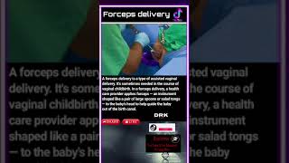 Forceps delivery [upl. by Geiss]