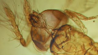 ПОД МИКРОСКОПОМ🐜 НАЕЗДНИК ТРИХОГРАММА БИОМЕТОД И ПАРАЗИТЫ ЯИЦTrichogramma Under Microscope UKRAINE [upl. by Demetris]