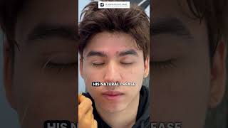 Transformative Journey Double Eyelid Surgery amp Ptosis Correction  Dr Kenneth Kim Plastic Surgery [upl. by Ardried]