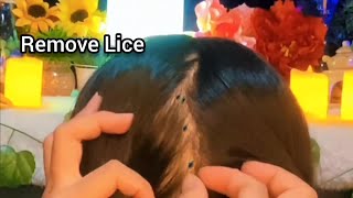 ASMR Remove Lice and their eggs  Scratching  No Talking 😴💤🥱 [upl. by Goddard]