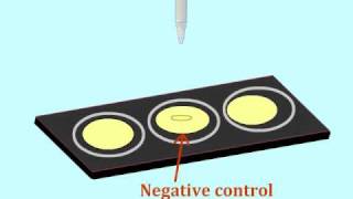 Agglutination assay to detect antigens  MultiLingual Captions [upl. by Yojal]