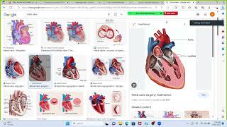 Heart murmurs simplified [upl. by Fosdick305]