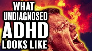 What Adult ADHD Can Look Like 🔍 [upl. by Wallis]