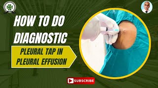 HOW TO DO DIAGNOSTIC PLEURAL TAP IN CASE OF PLEURAL EFFUSION COMPREHENSIVE GUIDE GEMS HOSPITAL [upl. by Milt624]