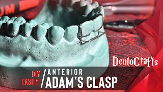 DIY EASILY ANTERIOR ADAMS CLASP  PRECLINICAL ORTHODONTICS  DENTISTRY [upl. by Orfield498]