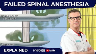 Failed Spinal Anesthesia Explained 1  Regional anesthesia Crash course with Dr Hadzic [upl. by Atilol]