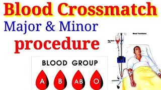 what is cross matching blood [upl. by Merfe]