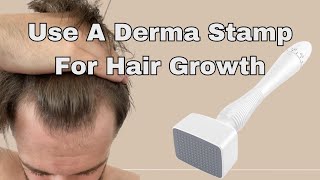 This Is How I Use My Derma Stamp For Hair Growth [upl. by Medorra12]