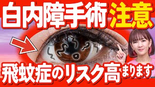 【⽩内障手術】多焦点眼内レンズの選び⽅を間違えると、⾶蚊症のリスクが⾼まります。 [upl. by Rollo777]