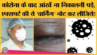 Corona के बाद Mucormycosis या Black Fungus से बचने के लिए Jaipur के Expert Doctor ने क्या सलाह दी [upl. by Eneleahcim]