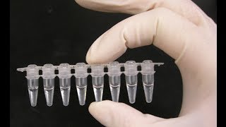 PCR optimization  PCR technique [upl. by Gaves]