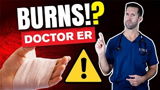 HOW TO TREAT A BURN — ER Doctor Explains Treating Burns Blisters Classifications amp Degrees [upl. by Ahseenal]