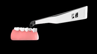 How to measure implant stability with Osstell Beacon [upl. by Adev11]