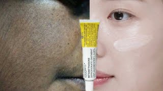 skin cream  betamethasone dipropionate cream  skin care  beauty tips  Brijwasi Girl [upl. by Chaney136]