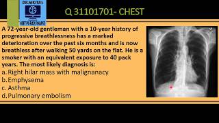 CHEST X RAY EMPHYSEMA COPD SIGNS [upl. by Etat]