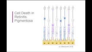 Retinitis Pigmentosa 2 Biology [upl. by Mowbray309]