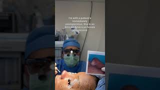 Ethnic rhinoplasty immediately postop  Anthony Bared MD FACS  Miami FL [upl. by Heber]