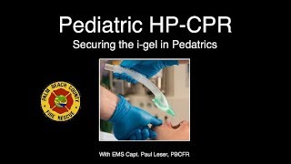 Securing the igel in Pediatric Cardiac Arrest [upl. by Nyad]