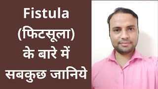 फीटसूला के बारे में सबकुछ जानिये  Everything about Fistula [upl. by Willette]