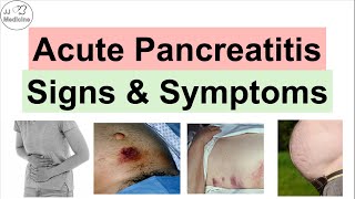 Acute Pancreatitis Signs amp Symptoms amp Why They Occur [upl. by Nerat]