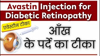 How Avastin Injection Helps Save Vision A CostEffective Solution  AvastinInjection [upl. by Onirotciv513]