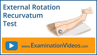 External Rotation Recurvatum Test [upl. by Darb]