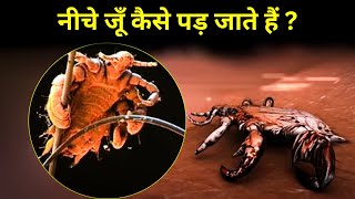 नीचे के बालों में जूँ कैसे पड़ जाते हैं  pubic lice [upl. by Anahpos]