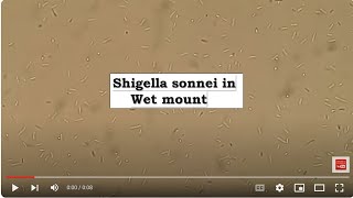 Shigella sonnei in Wet mount Microscopy [upl. by Akelahs]