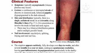 2 Lichenoid Review ✅ Lichen nitidus 🔸 Lichen striatus 🔸 Graft versus host disease by Dr Ahmed Kamel [upl. by Zerline]