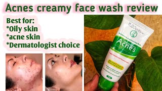 Mentholatum acnes creamy wash for oily and acne skin [upl. by Selene]