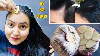 30 Days Hairline Regrowth Challenge  Receding Hairline Bald Patches हल्के बालों को करें घना 100 [upl. by Kcirederf]