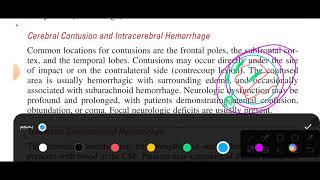 chapter 160 tintinalli emergency medicine head trauma [upl. by Enitsud]