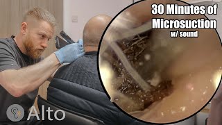 30 Minutes of MICROSUCTION Ear Wax Removal [upl. by Honna355]