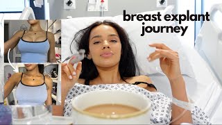 my breast explant journey  augmentation vlog [upl. by Rehtse]