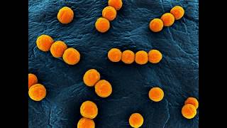 Enterococcus faecalis [upl. by Ahcilef]