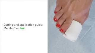 How to apply Mepilex on a toe [upl. by Hornstein]