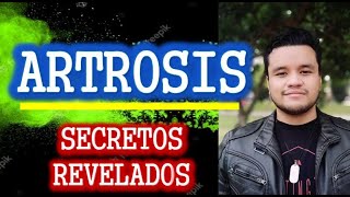 ✅ ARTROSIS  ¿Qué es la Artrosis Cuadro Clínico Tratamiento  Infiltración de rodilla [upl. by Sidalg]